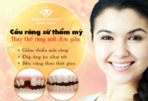 Địa chỉ bọc răng sứ thẩm mỹ uy tín tại Hà Nội: Bạn đã biết chưa?