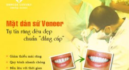 Mặt dán sứ Veneer siêu mỏng – Răng đẹp tự nhiên, không cần mài răng