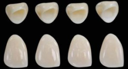 Ưu điểm của răng sứ Cercon – Điểm cộng khiến nhiều người lựa chọn