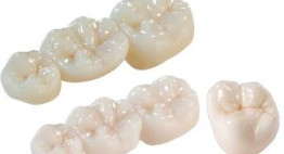 Răng sứ Cercon Zirconia – Dòng răng toàn sứ với những ưu điểm vượt trội