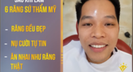 Bọc răng sứ 2in1 cho hàm răng trắng đẹp bất chấp giới tính, tuổi tác