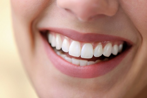 răng sứ cercon zirconia 6