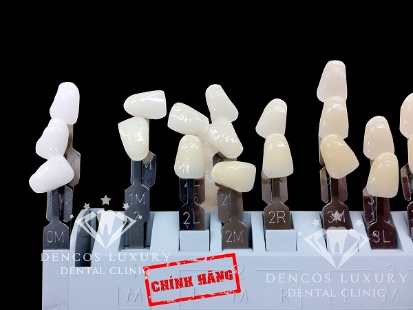 răng cửa bị thưa phải làm sao?