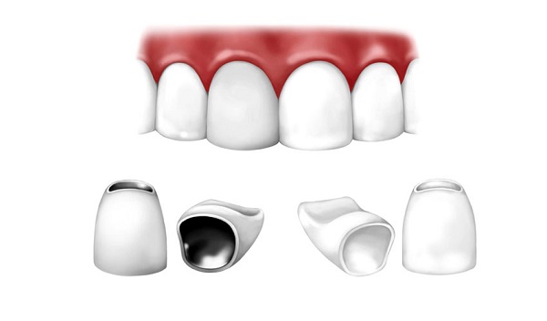 tháo răng sứ làm lại có đau không 