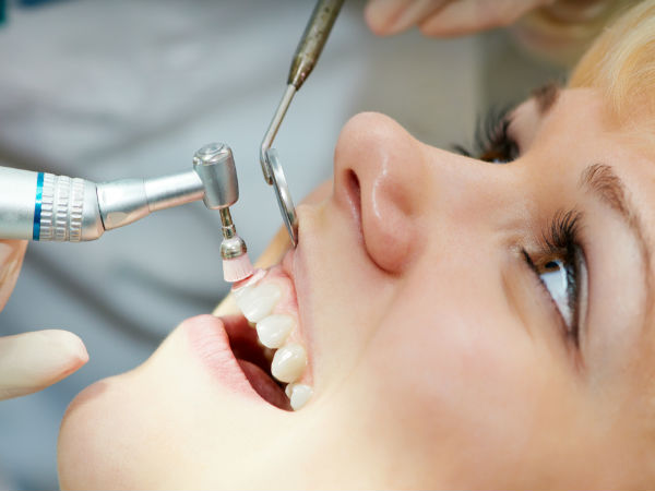 Lấy cao răng bằng máy siêu âm