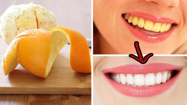Cách làm trắng răng tại nhà 