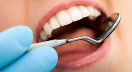 Răng sứ kim loại – Chuyên gia nha khoa trả lời những câu hỏi thường gặp