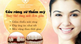 Cầu răng sứ thẩm mỹ – Thay thế răng mất đơn giản, tiết kiệm chi phí