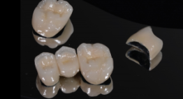 Bạn đang muốn bọc răng sứ Titan thì đừng bỏ qua bài viết này!