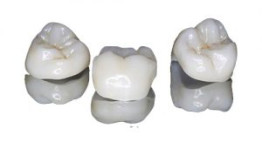 Sự chênh lệch về giá của 1 chiếc răng sứ là do đâu?