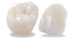 Nắm rõ đặc điểm của răng toàn sứ Emax để có sự lựa chọn tốt nhất