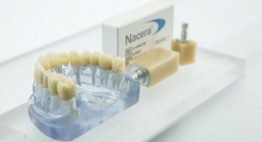 Bọc răng sứ Nacera mang đến tính thẩm mỹ tối ưu cho hàm răng