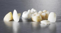Bọc răng sứ Vita: Đừng bỏ lỡ những thông tin cần thiết dành cho bạn