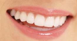 Tìm ra giải pháp chỉnh răng cửa cho mọi trường hợp NHANH – GỌN – LẸ