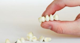 Bọc Răng Sứ Có Tháo Ra Được Không? Cách tháo răng sứ An Toàn nhất