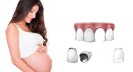 Bọc răng sứ khi mang thai – Nên thực hiện hay không?
