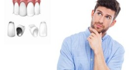 Nam giới có bọc răng sứ được không? – Bất ngờ với đáp án thật sự