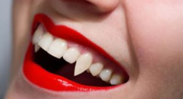 Đắp răng nanh bao nhiêu tiền để sở hữu răng đẹp như Ma cà rồng?