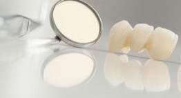 Răng sứ không kim loại: Tự nhiên, bền chắc, ăn nhai như răng thật