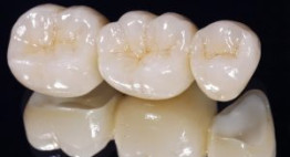 Giá làm răng sứ zirconia bao nhiêu là phù hợp hiện nay?