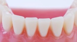 Tác hại của bọc răng sứ khi chọn nhầm địa chỉ nha khoa