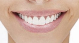 Tại sao phải Bọc Răng Sứ? – Những lợi ích mà phương pháp này mang lại