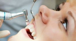 Lấy cao răng bằng máy siêu âm – Giải pháp chuyên gia khuyên dùng
