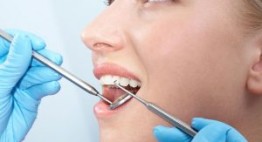 Những cách chăm sóc nha chu giúp răng lúc nào cũng chắc khỏe