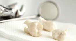 Nhổ răng bao nhiêu tiền hiện nay? – Cập nhật bảng giá mới