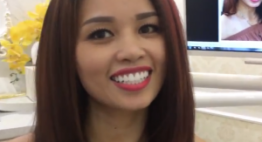 Bọc răng sứ công nghệ cao: Răng khỏe mạnh, sáng rạng ngời