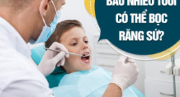 Bao nhiêu tuổi có thể bọc răng sứ? – Độ tuổi để đảm bảo AN TOÀN?