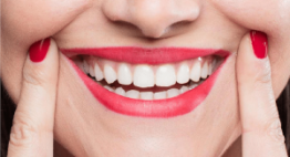 Bọc răng sứ là gì? – Quy trình làm răng sứ chuẩn xác tại nha khoa