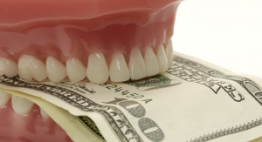 Chi phí làm răng sứ thẩm mỹ tại Dencos Luxury – Giá trị tạo nên đẳng cấp