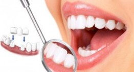 Xóa tan tình trạng hôi miệng vì răng giả đơn giản