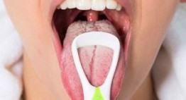 Miệng khô lưỡi trắng là bệnh gì?- Ảnh hưởng như thế nào?