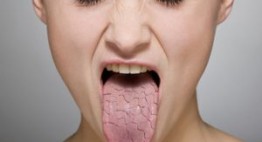 Nguyên nhân khô miệng bạn không thể ngờ