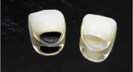 Bọc răng Titan có tốt không << Xem ngay kẻo lỡ [Giải đáp Nha Khoa]