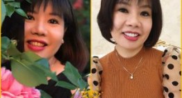 Hình ảnh bọc răng sứ đẹp được cập nhật hàng ngày