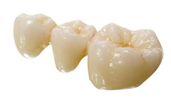 làm cầu răng sứ